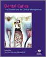 9781405107181-Dental-Caries