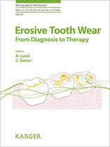 9783318025521-Erosive-Tooth-Wear