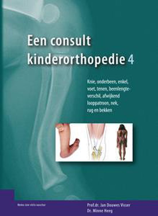 9789080333000 4 een consult kinderorthopedie