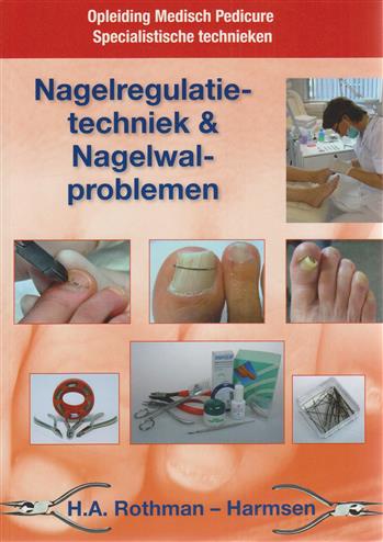 9789082161007 Nagelregulatietechniek en nagelwalproblemen