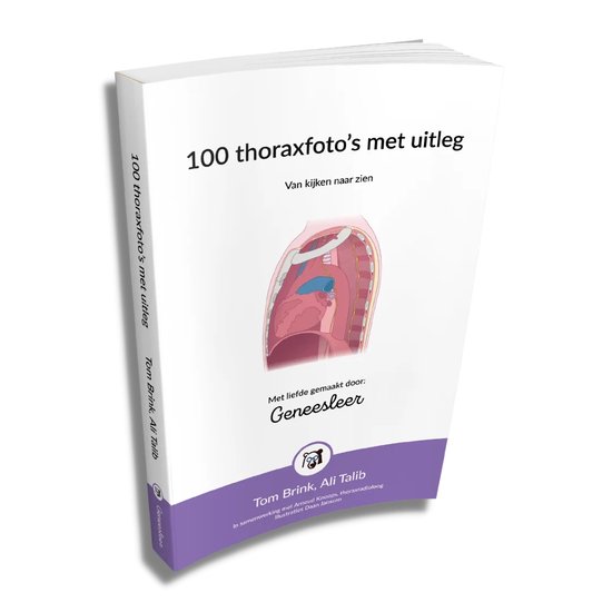 9789083223209 100 thoraxfotos met uitleg  Van kijken naar zien