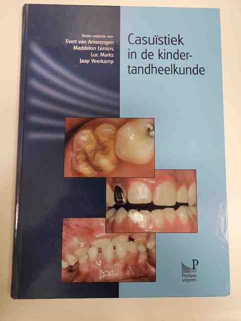 9789085620327-Casuistiek-in-de-kindertandheelkunde-1