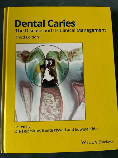 9781118935828-Dental-Caries