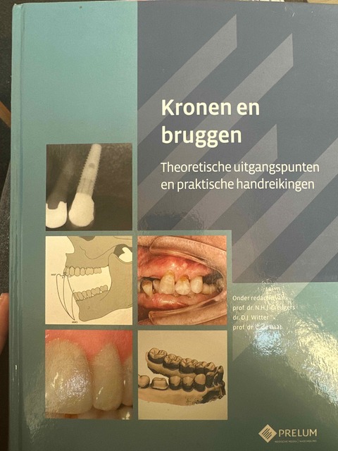 9789085621348-Kronen-en-bruggen