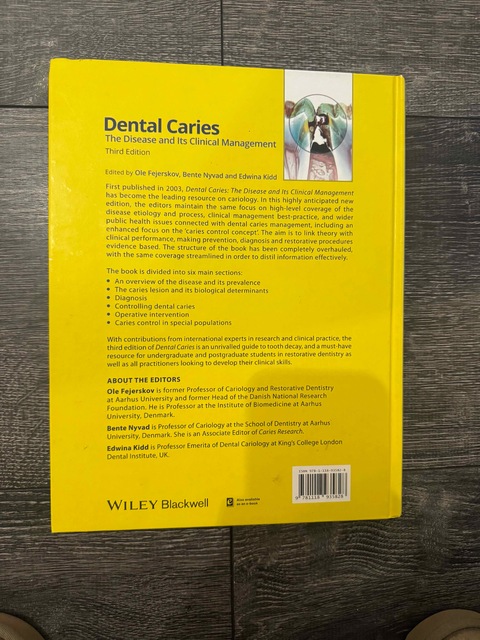 9781118935828-Dental-Caries