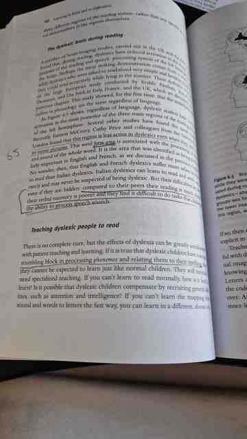 9781405124010-The-Learning-Brain